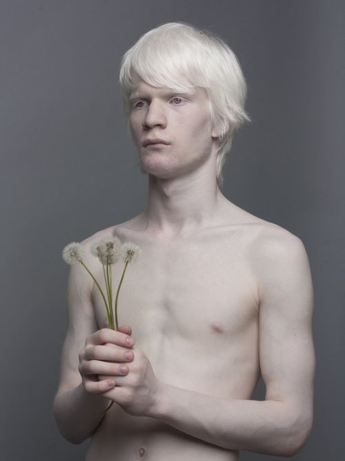 Modelos albinas como Thando Hopa encantam o mundo.