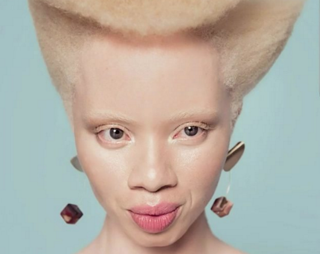 Modelos albinas como Thando Hopa encantam o mundo.