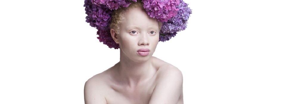 modelos albinos