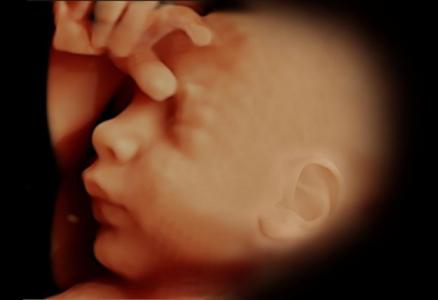 Em 4 semanas de gestação é possível reconhecer características faciais no bebê